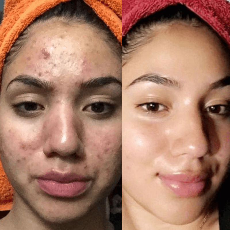 meTime™ Turmeric Soap