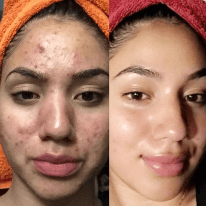 meTime™ Turmeric Soap